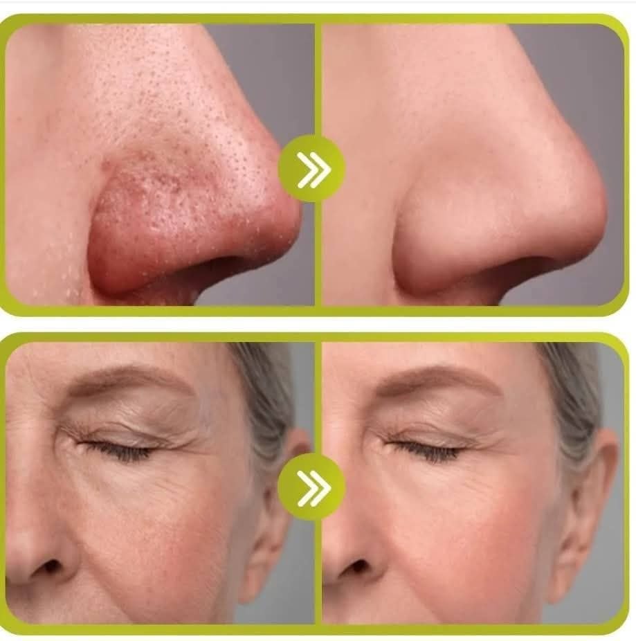 سيروم الريتينال الأصلي